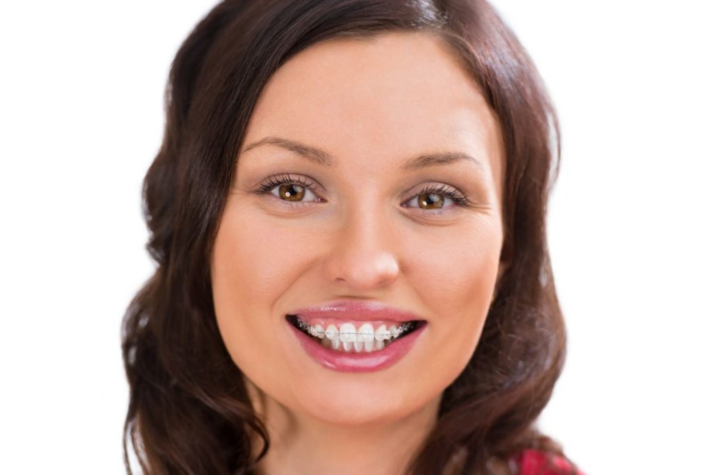 woman who had her teeth whitened by a dentist