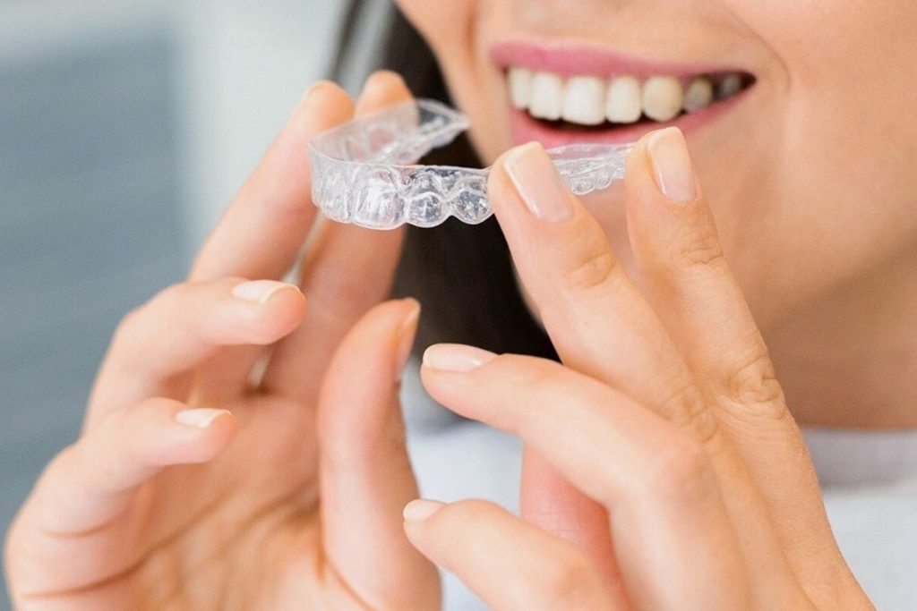 middle aged woman trying out aligners