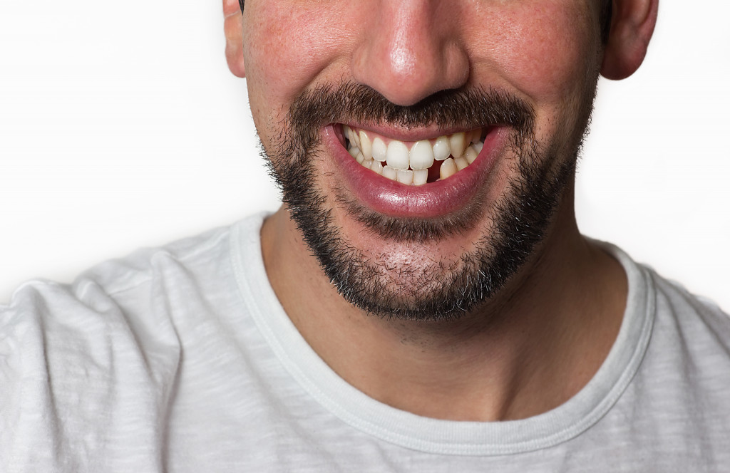 Close up on a man smiling while he is missing a tooth