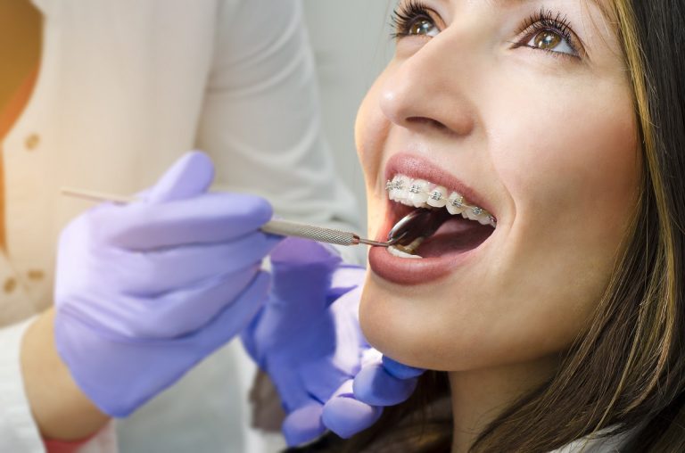 woman in braces for dental check up